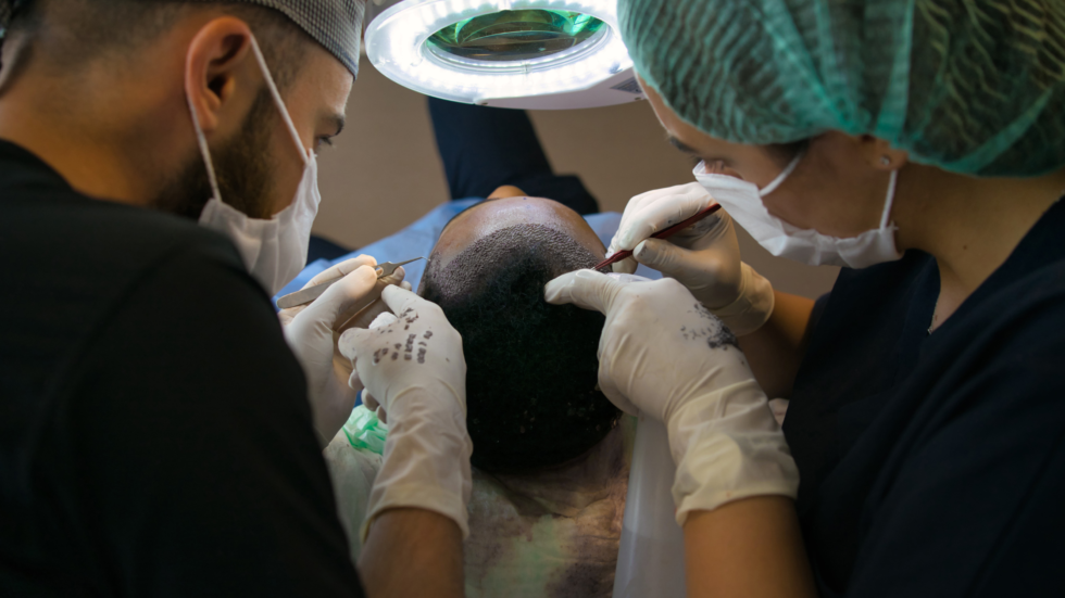 Hair <b>Transplant Cost in Mysore</b>