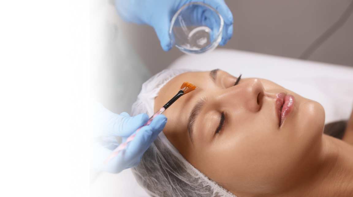 Chemical Peel Treatment Mysore
