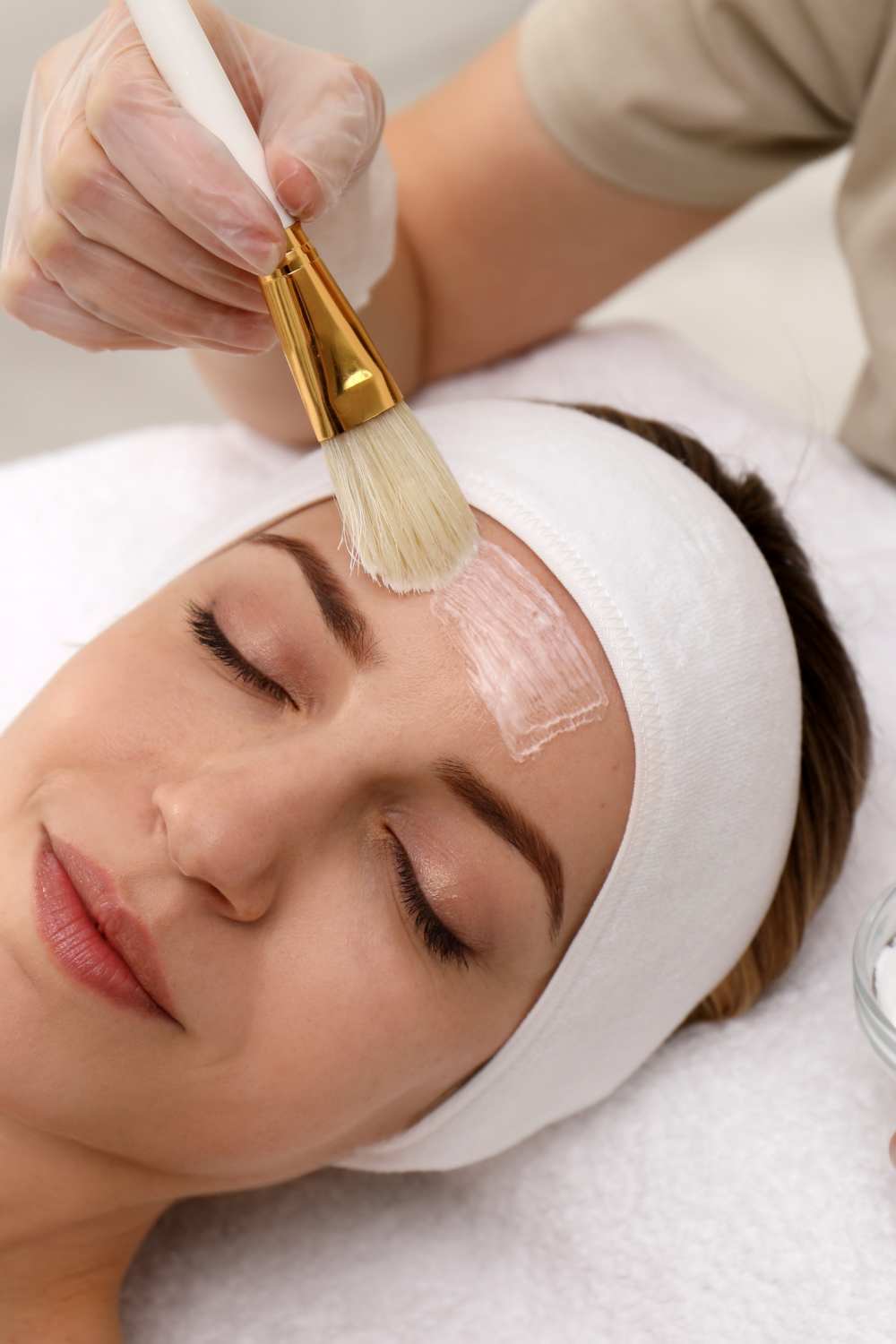 Face Peel Treatment Mysore