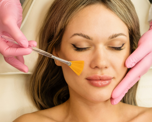 Combination Peel Mysore