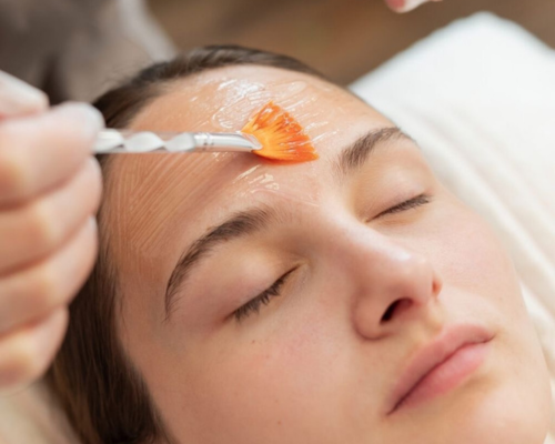 Salicylic Peel Mysore