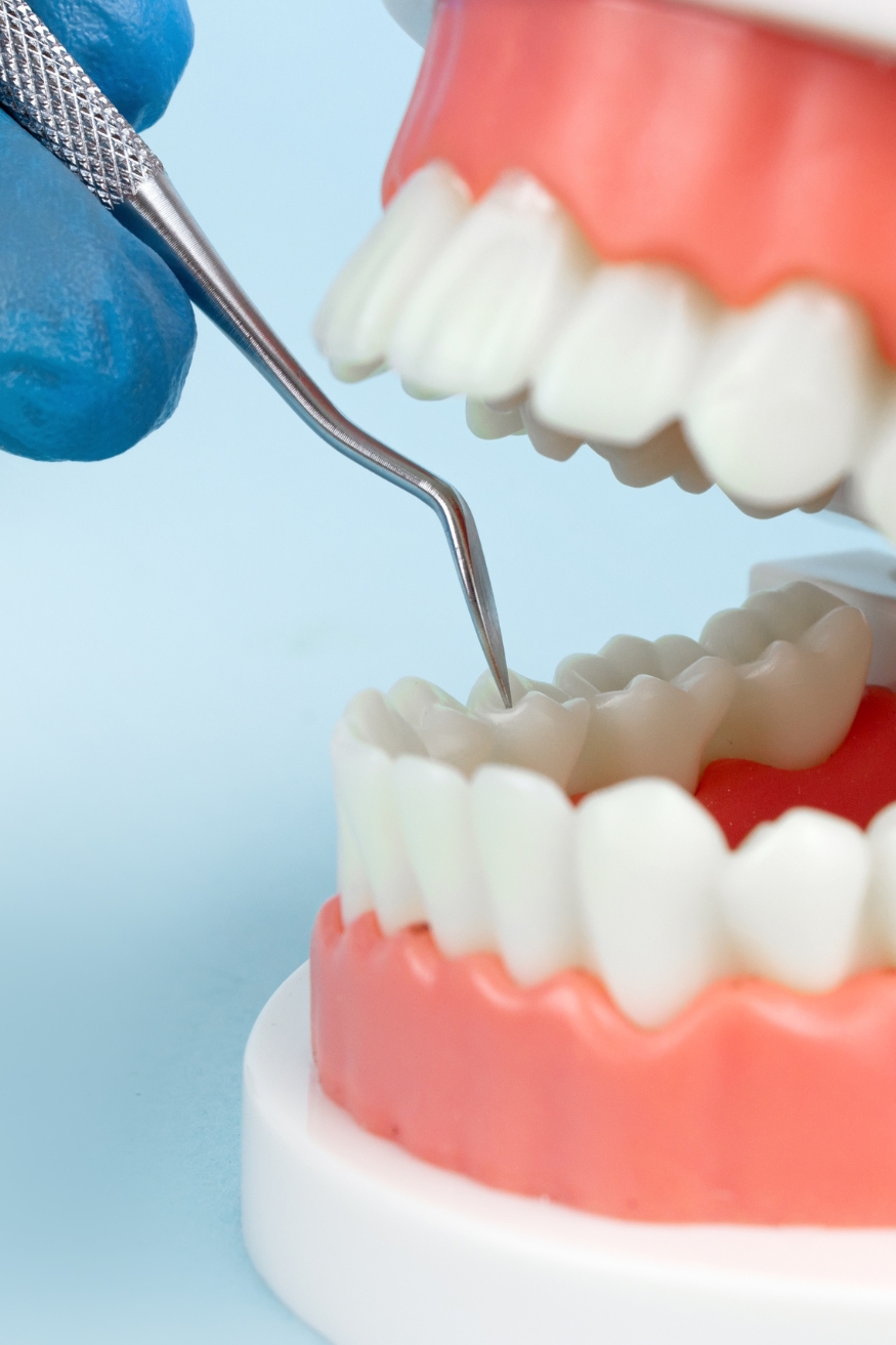 Full Mouth Denture Mysore