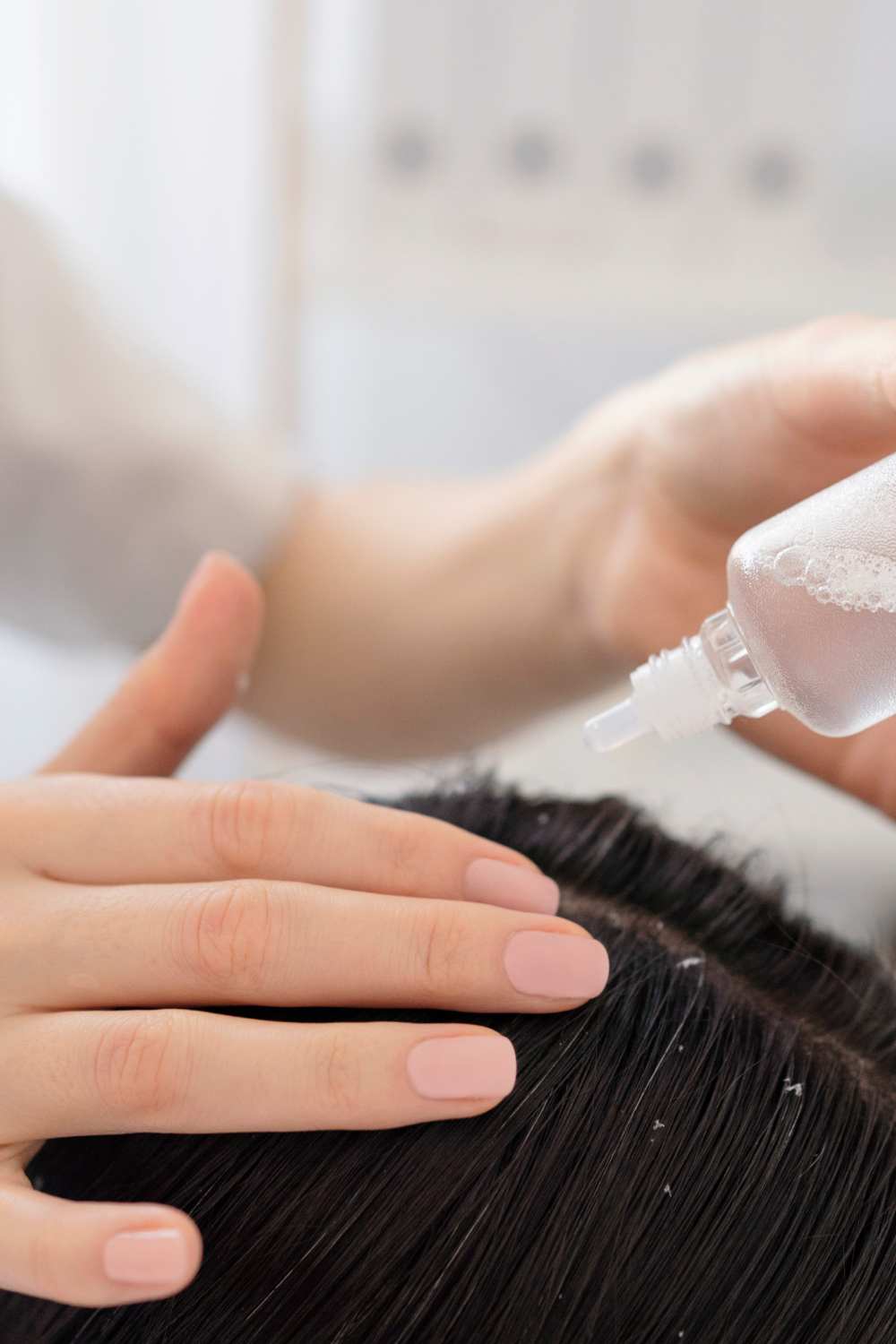 Anti-Dandruff Treatment Mysore