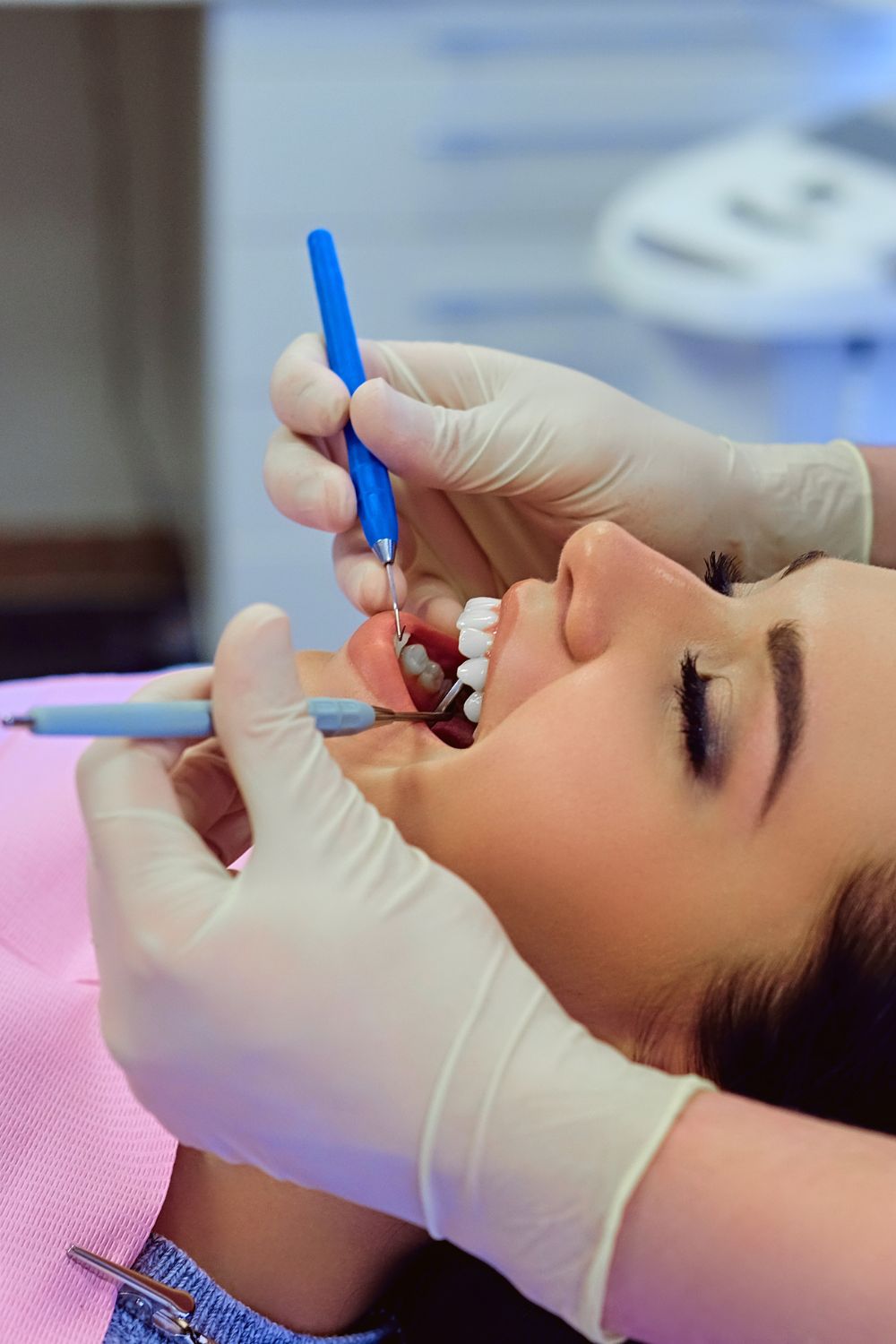 Advanced Teeth Cleaning and Polishing Procedure in Mysore