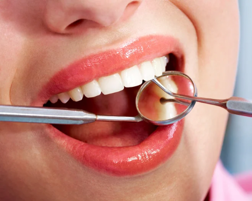 Ultrasonic Teeth Cleaning Scaling in Mysore