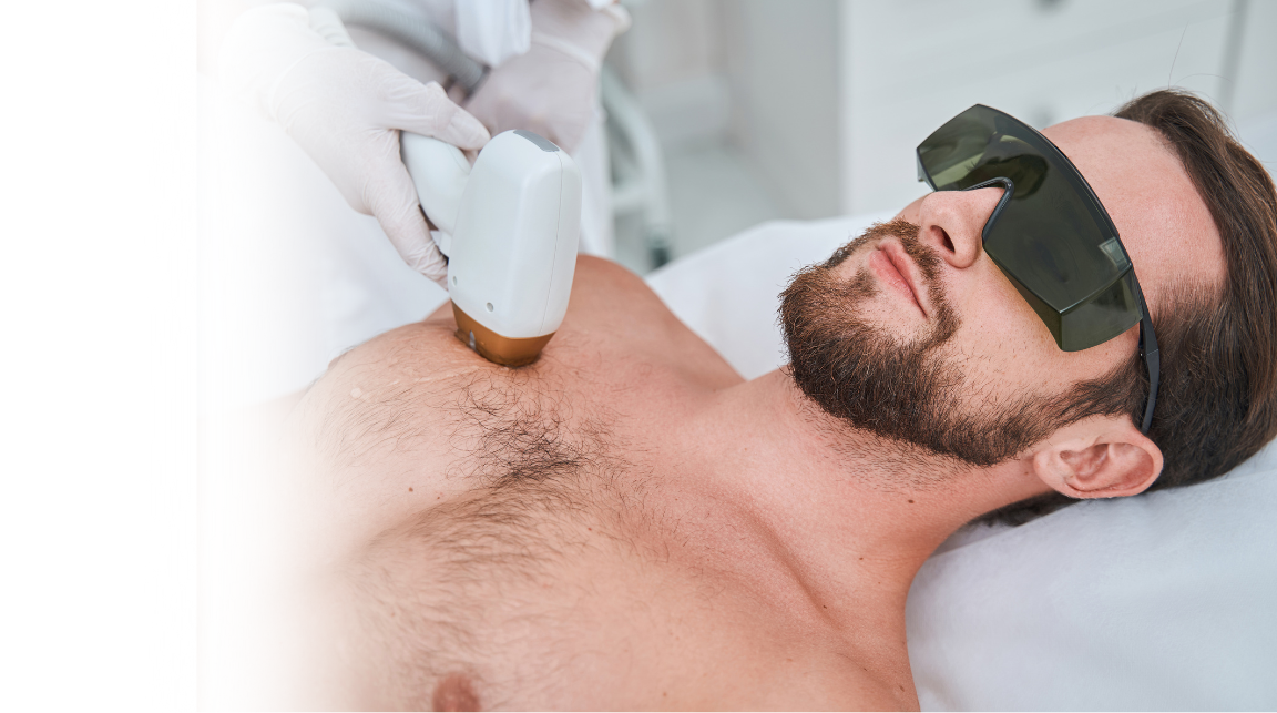 Laser hair removal treatment for face and body at Umbrella Aesthetics skin clinic Mysore