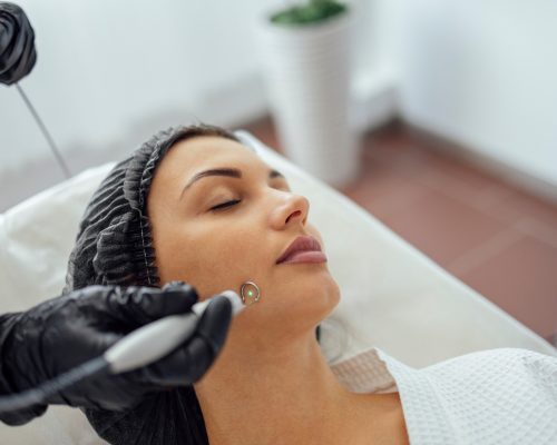 Laser Pigmentation Removal Mysore