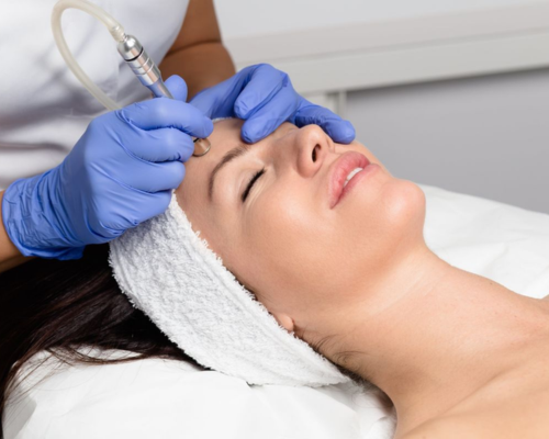 Laser Scar Removal Mysore