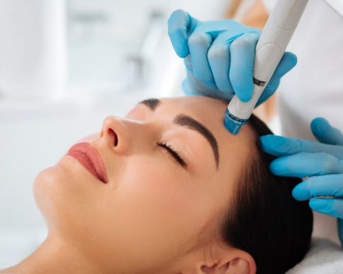 Smoother, matte skin after carbon laser treatment at Umbrella Aesthetics Mysore