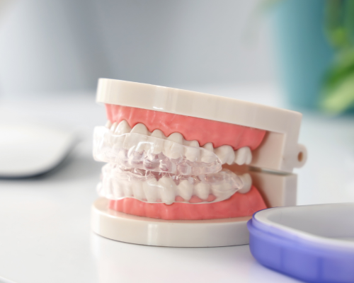 Bite Correction Braces Mysore