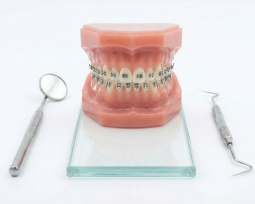 Mini Metal Brackets Mysore