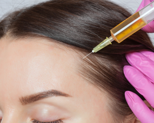 Natural hair regrowth after GFC treatment at Umbrella Aesthetics Mysore