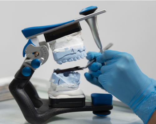 Microscopic RCT Mysore