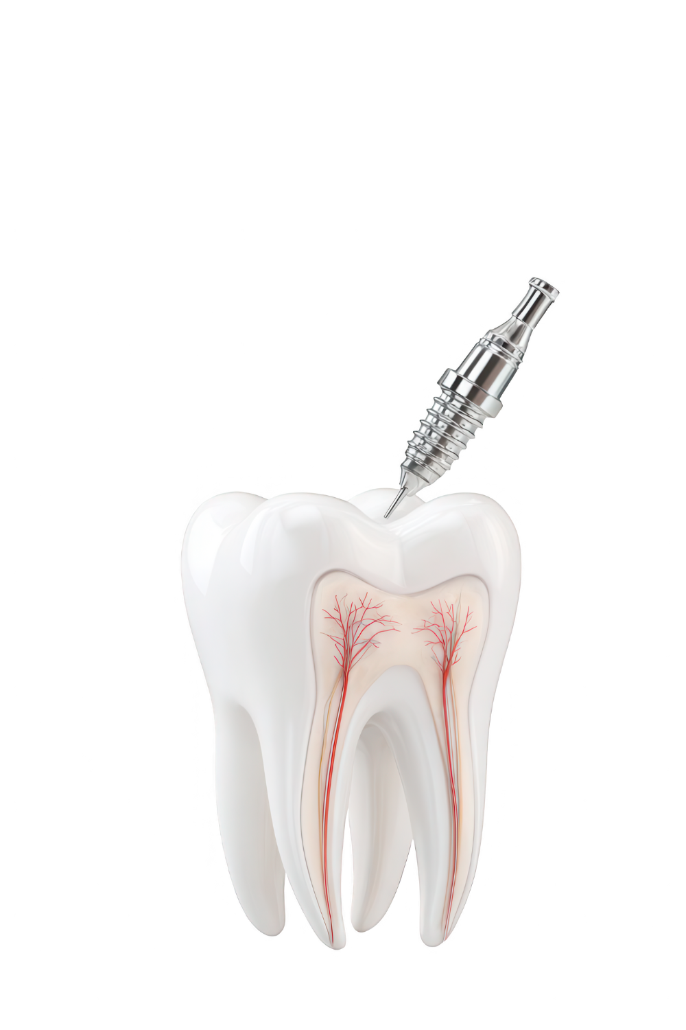 Painless Root Canal Mysore