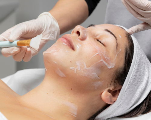 Chemical Peel Mysore