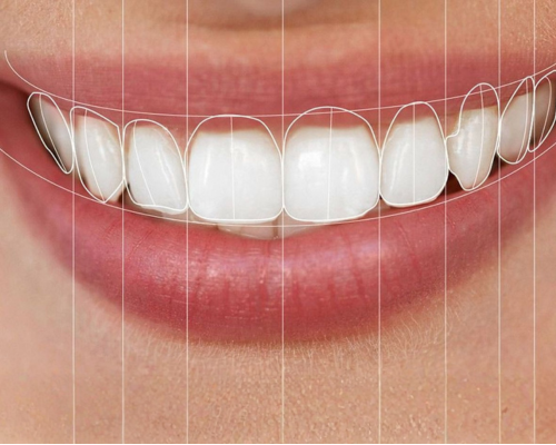 Digital Smile Design Mysore