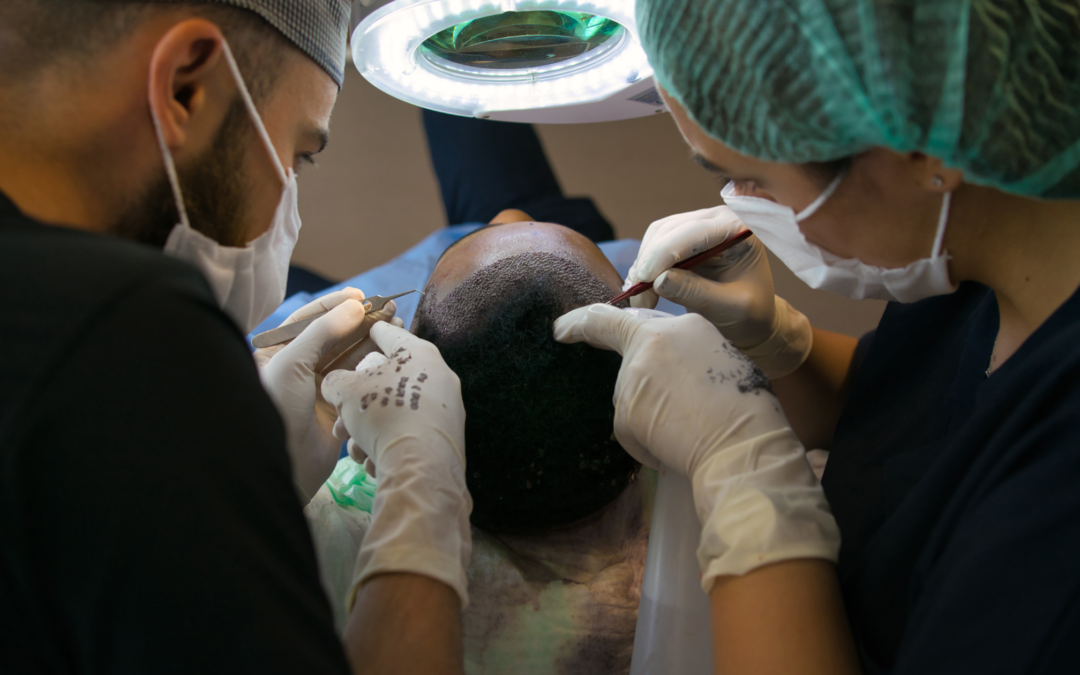 hair transplant cost in mysore